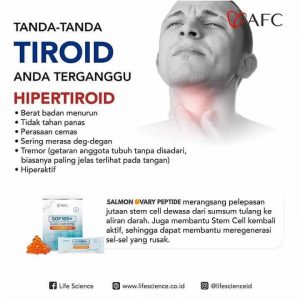 Hipertiroid
