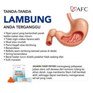 Lambung