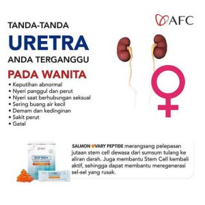 Uretra-Wanita