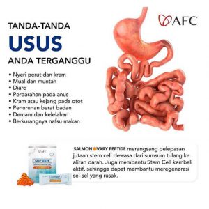 Usus
